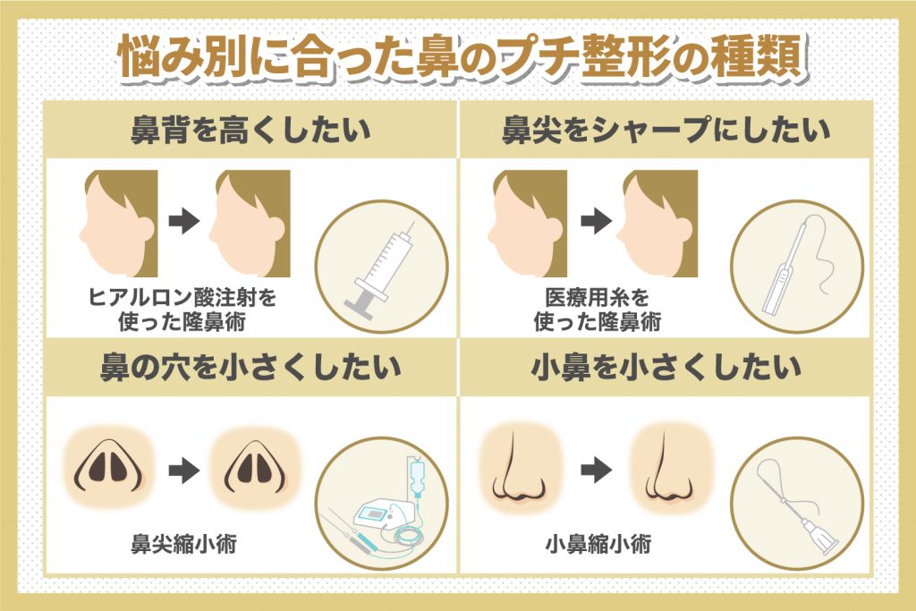 悩みに合った鼻のプチ整形の種類