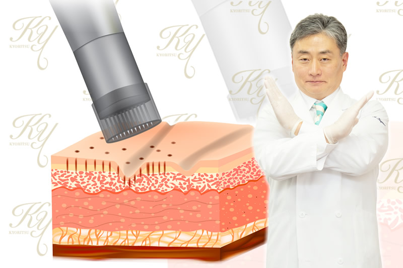 垂直にさせないダーマペン