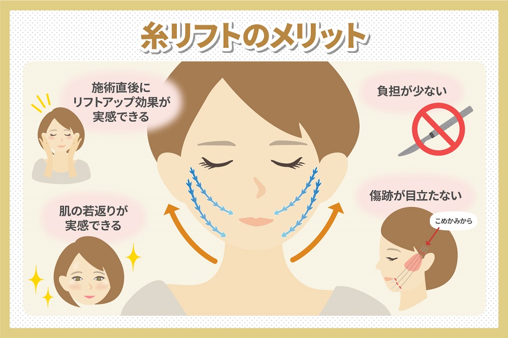 糸リフトのメリットとデメリットとは?