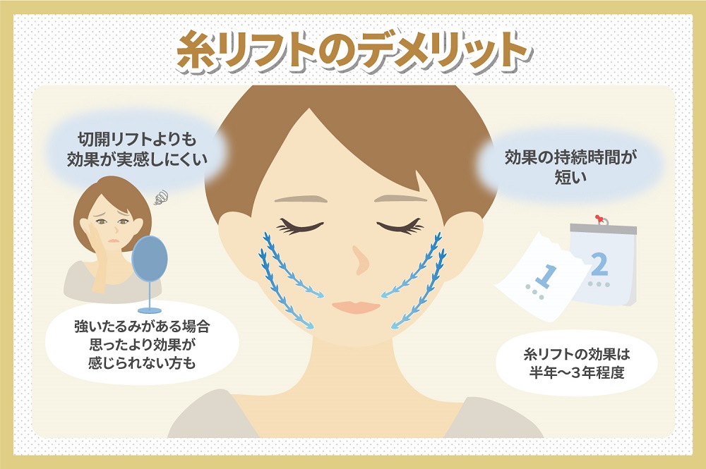 糸リフトのデメリット