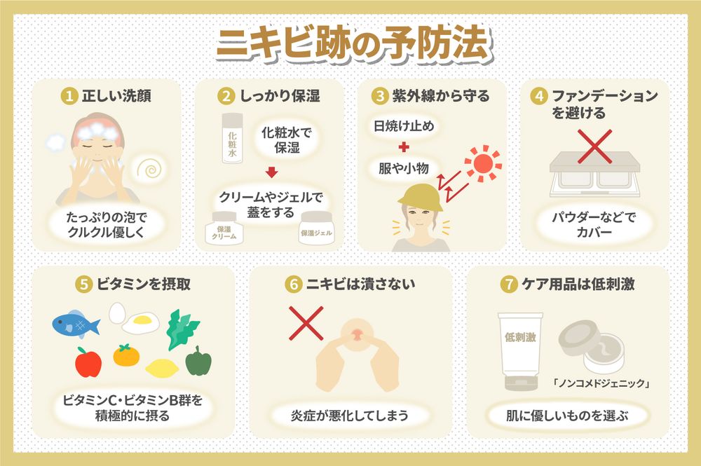 ニキビ跡の予防法
