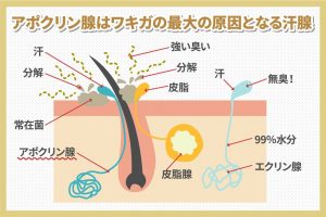アポクリン腺はワキガの最大の原因となる汗腺