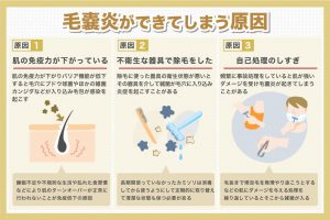 毛嚢炎ができてしまう原因