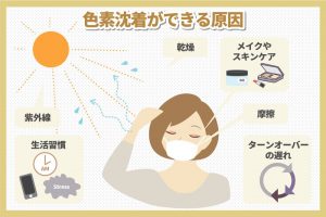 色素沈着ができる原因