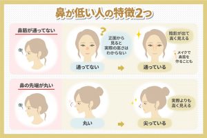 鼻が低い人の特徴2つ