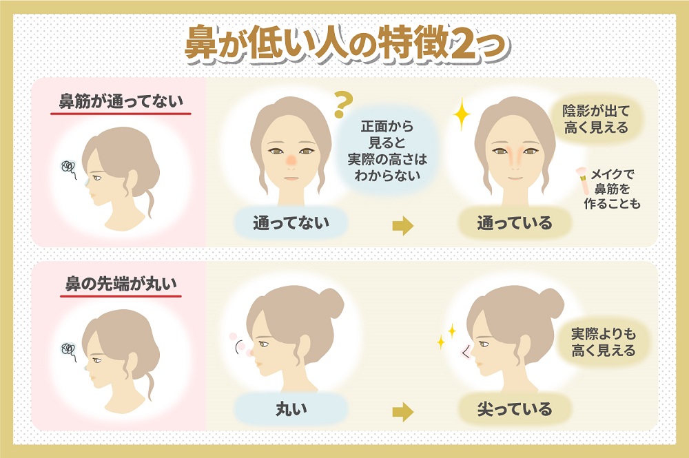 鼻が低いとは?見分け方と、高く見せる方法・高くする方法
