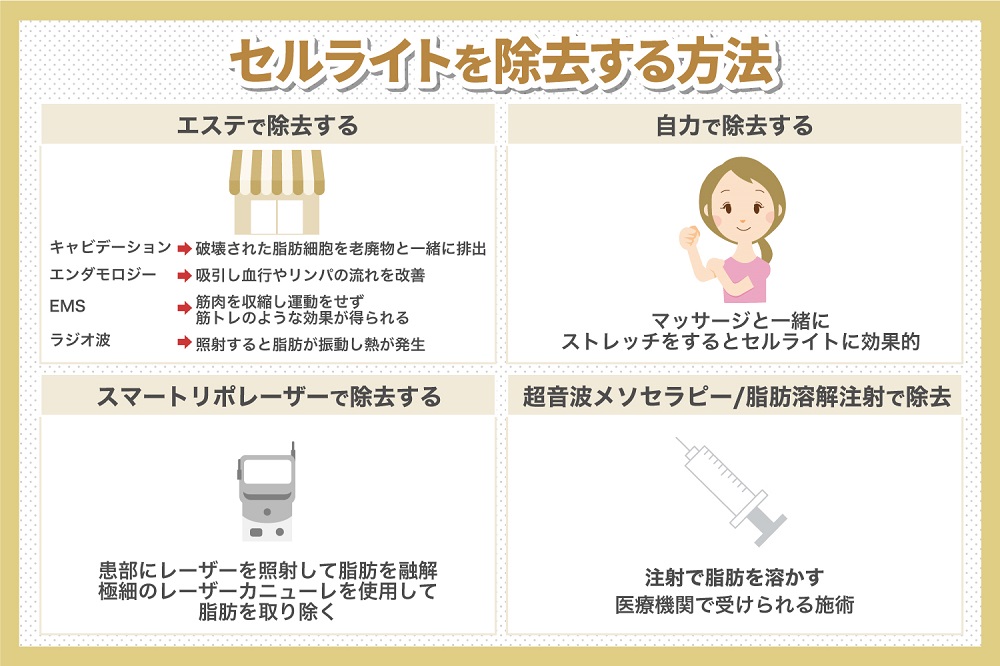 セルライトを除去する方法