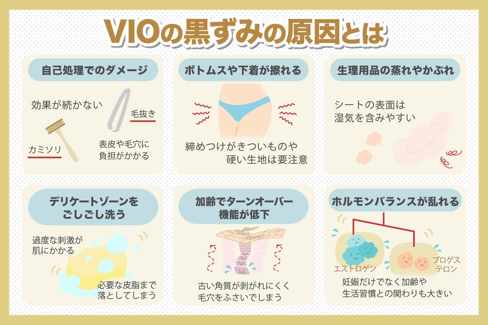 VIOの黒ずみはどう対処すればいい?原因と対策をご紹介