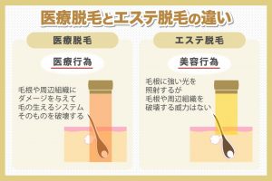医療脱毛とエステ脱毛の違い