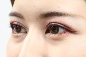 二重になった女性