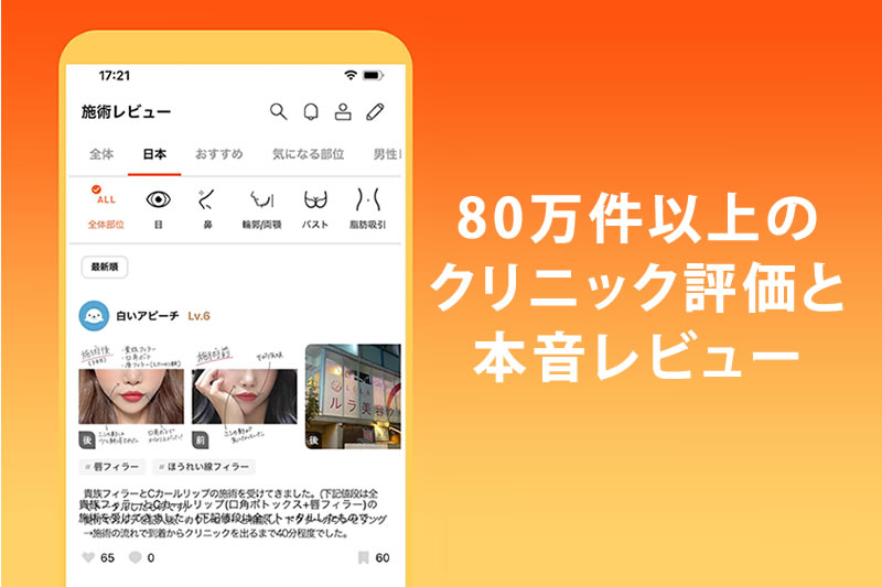 口コミが見られることの紹介