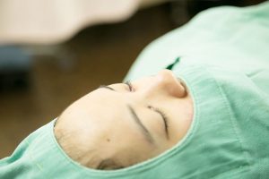 目頭切開の手術中の女性の目元