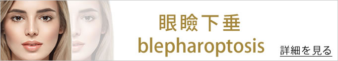 眼瞼下垂の詳細を見る