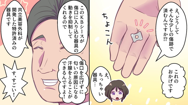 KBシースを説明する医師