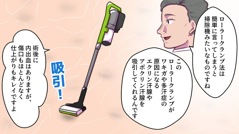アポクリン汗腺を吸引する仕組みを説明する医師