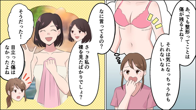 豊胸の傷跡を説明する女性