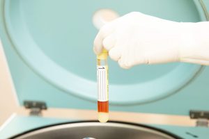 PRPを遠心分離機から取り出しているところ