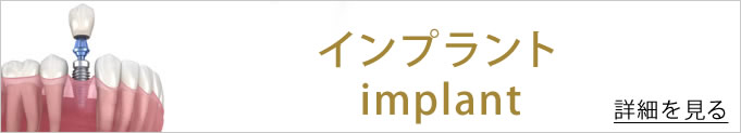 インプラントのバナー