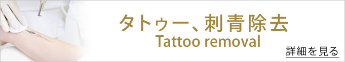 タトゥー 入れ墨 除去 へのバナー