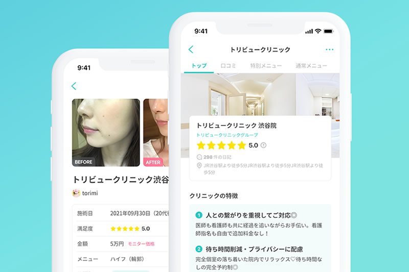 整形の口コミアプリ「トリビュー」のポイントや謝礼、クーポンコードなどを徹底解説!