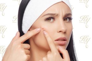 ニキビを潰す女性