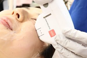 ハイフをゴルゴラインに当てているところ