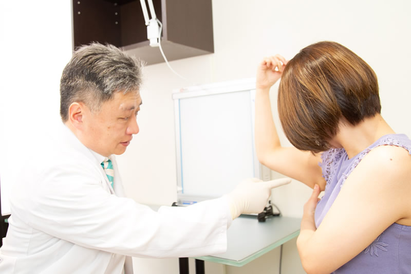 二の腕の脂肪吸引の診察をしているところ