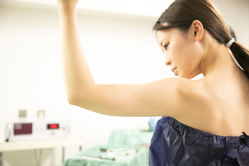 二の腕の脂肪吸引はすぐに細くならない?効果が現れて完成までの期間を美容外科医が解説