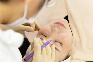 二重の埋没法の手術をする医師