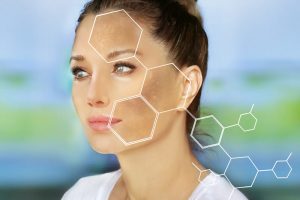 肝斑のある女性