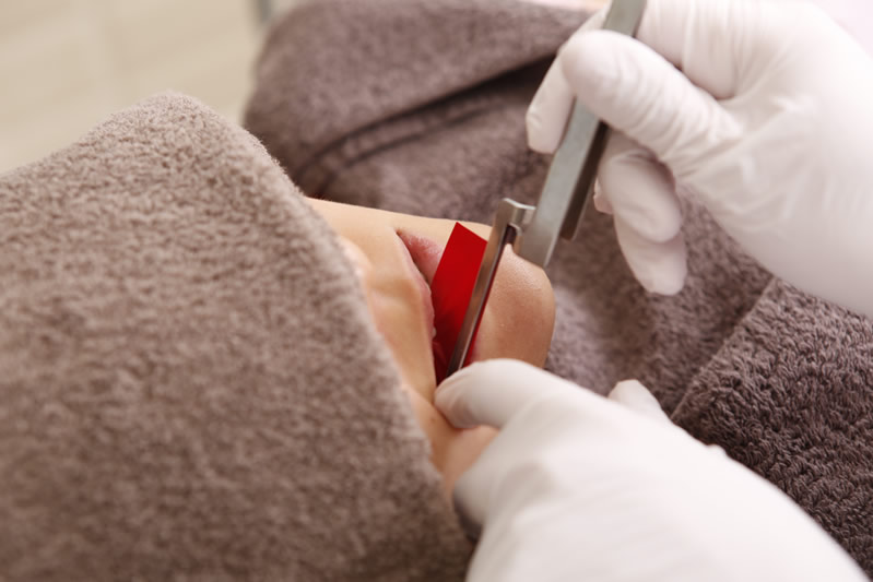 歯のかみ合わせを確かめているところ