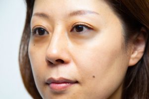 目の下のクマがきになる女性