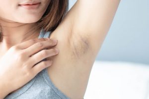 脇の臭いを気にする女性