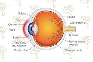 角膜が傷ついているイメージ
