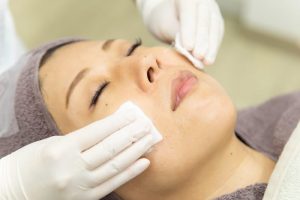 マッサージピールの施術を受けている女性