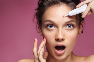 おでこのニキビに悩む女性