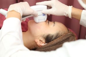 ハイフの施術中