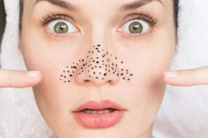 毛穴が汚い女性のイメージ