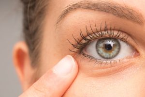 目の下のたるみを指で指す女性