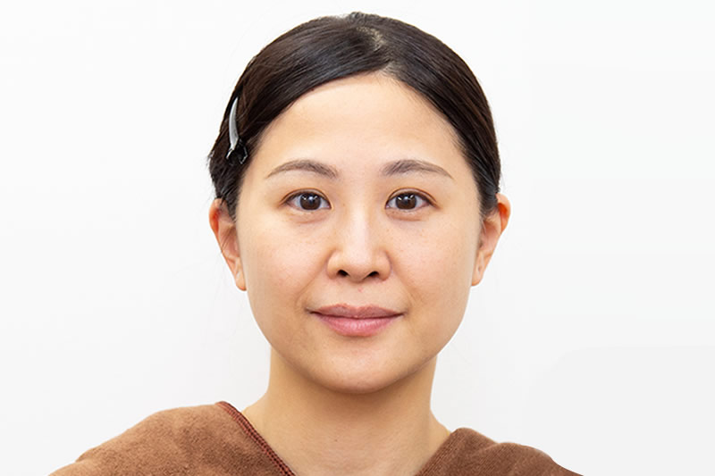 糸リフトの手術前の症例
