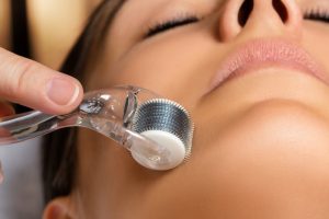 顔にダーマローラーをしているところ