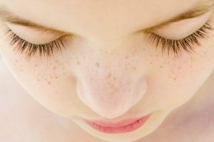 そばかすが頬と鼻にある女性