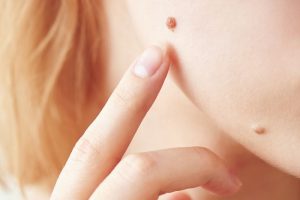 ほくろを指さす女性