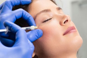 ヒアルロン酸を目尻に注入しているところ