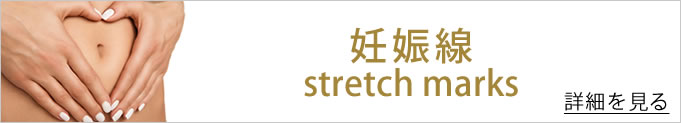 妊娠線へのバナー