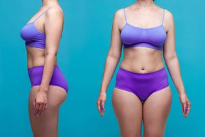 胸が垂れている女性