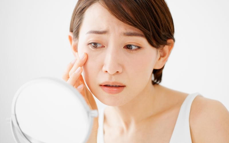 目の下のクマを気にしている女性
