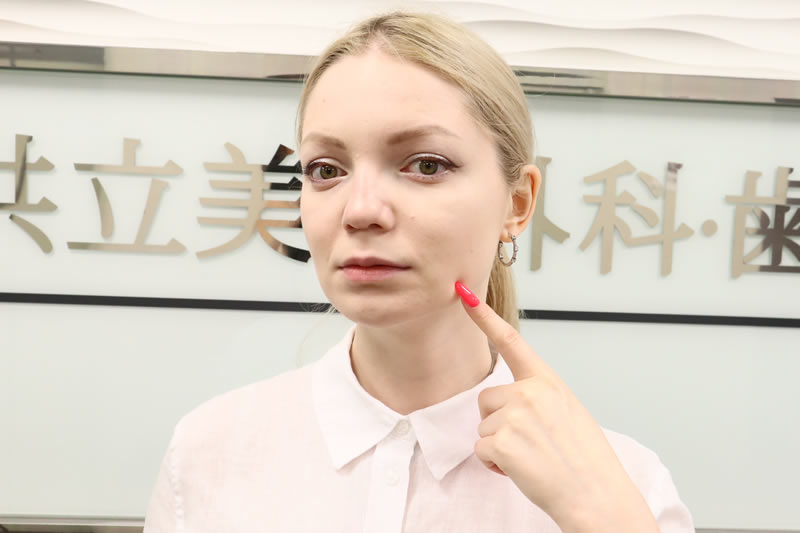 共立美容外科の前で肌を指さす女性