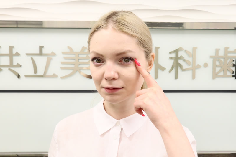 眼瞼下垂の手術で共立美容外科を案内する女性