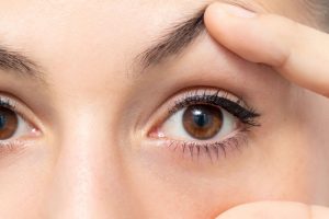 瞼にお悩みの女性